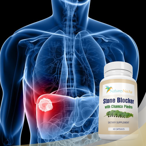 Image of STONE BLOCKER Chanca Piedra – Natural Kidney stone &  Gallbladder dissolver for max protection